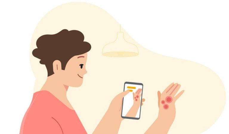 AI Buatan Google Bantu Identifikasi Kesehatan Kulit